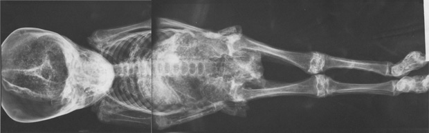 X-ray of mummy boy