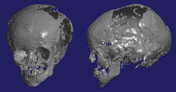 Model of child mummy skull.